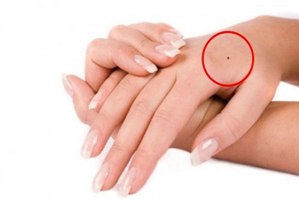 Nốt ruồi trên mu bàn tay trái phải phụ nữ nói lên điều gì